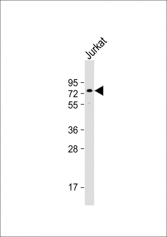 WB - CPSF6 Antibody (N-term) AP20278a